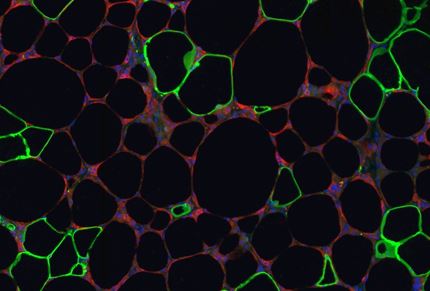 Fluorescent microscopy image of fatty tissue from an obese mouse