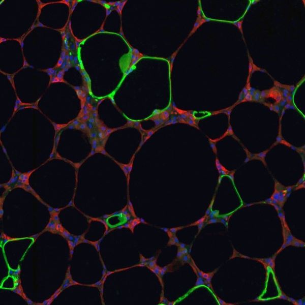 Fluorescent microscopy image of fatty tissue from an obese mouse